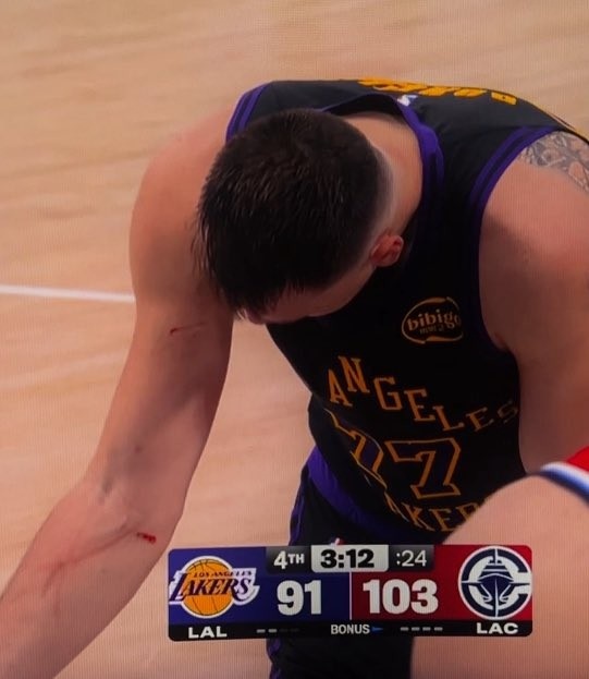 开云体育官网-谁抓的~东契奇罚球时看向手臂 好几道伤口&amp;血迹斑斑